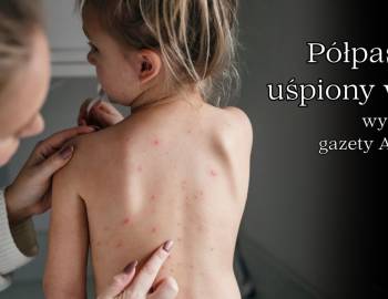 Półpasiec – uśpiony wirus